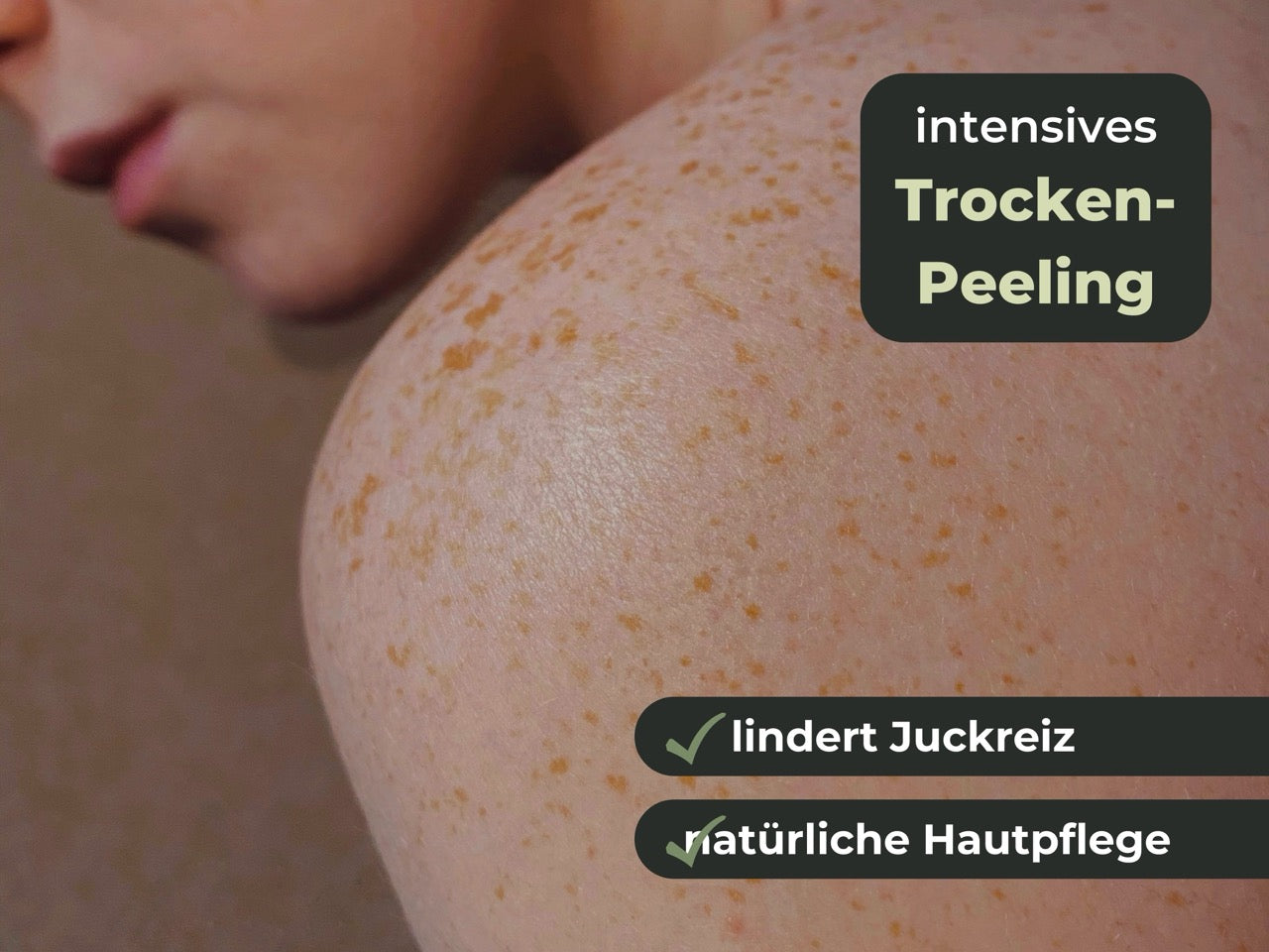 Nahaufnahme von Schulter mit Sommersprossen, Text zu intensivem Trockenpeeling, Hautpflege und Juckreizlinderung