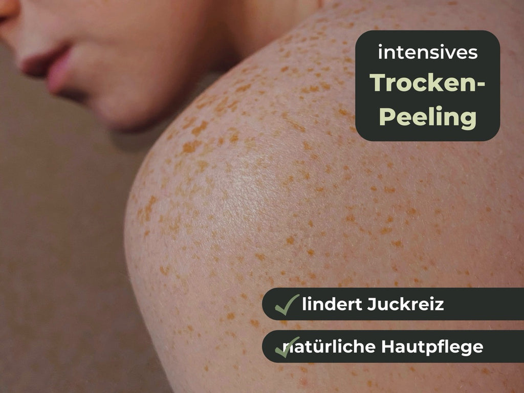 Nahaufnahme eines Damenrückens mit Sommersprossen und Text zu intensivem Trockenpeeling für natürliche Hautpflege und Juckreizlinderung